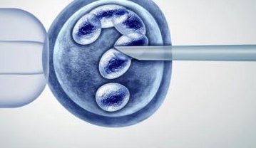 试管婴儿丨少弱精做人工受精失败，试管婴儿喜获双胎