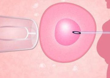 沈阳的正规试管婴儿医院收费标准是怎样的？治疗流程是怎样的？