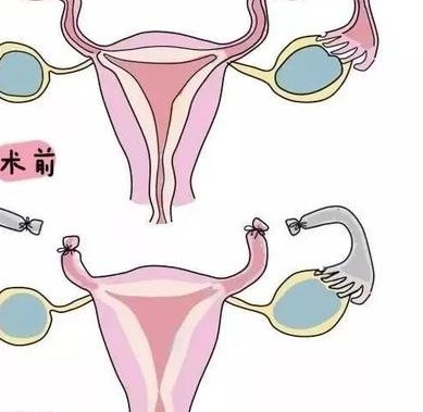 淮南三代试管在哪里做比较好？